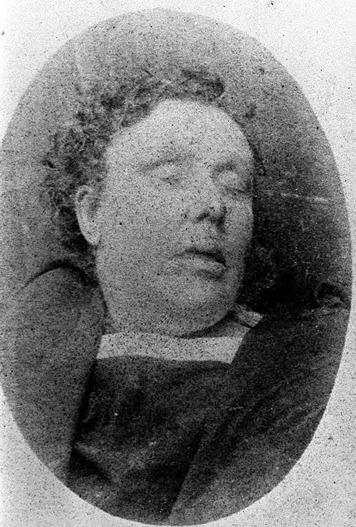 Mortuary photograph of Annie Chapman